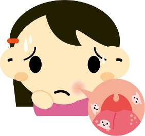 口内炎を痛がる女の子のイラスト